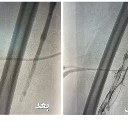 ضبط منشأة مخالفة تستخدم مستودع للمواد الغذائية من قبل عمالة بغرب الدمام